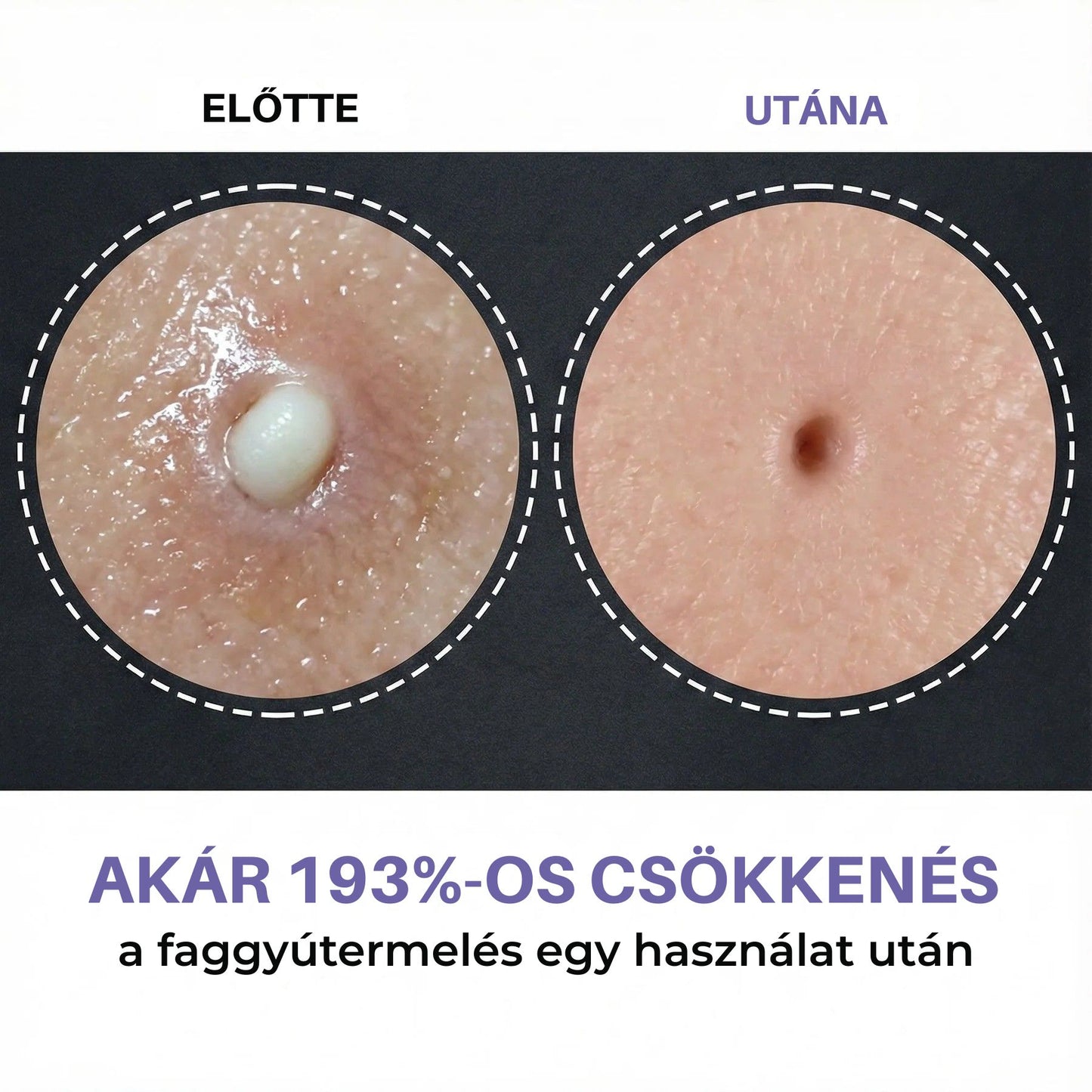 Zenovyra Peel Shot