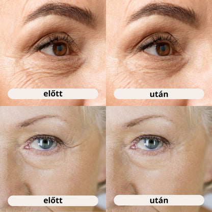 Zenovyra - Calcium Complex™