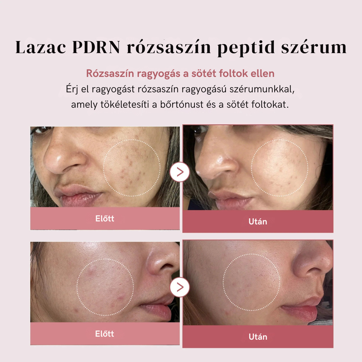 PDRN Pink Serum Peptide – Mélyhidratálás, "Glass Skin" hatás