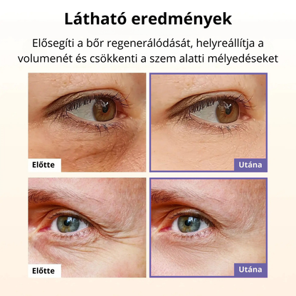 Zenovyra - Calcium Complex™